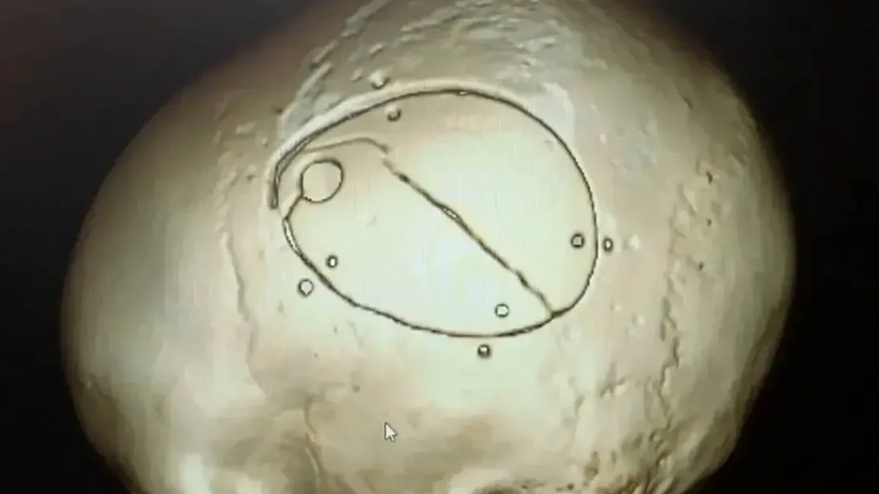 В Кемерово пятилетний ребёнок получил серьёзную...